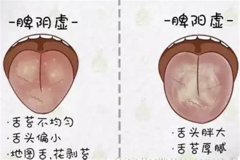 脾臟功能不好|吃不多又脹氣、舌邊有齒痕 中醫：脾胃虛寒，2款湯方。